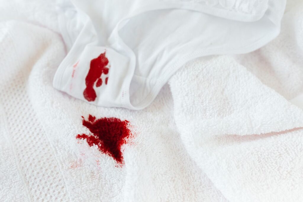 Manchas de sangre en ropa blanca