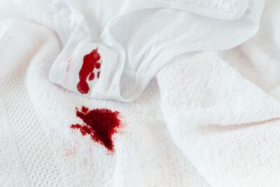 Cómo eliminar manchas difíciles en ropa blanca sin estropearla